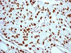 Immunohistochemistry (Formalin/PFA-fixed paraffin-embedded sections) - Anti-gamma H2A.X (phospho S139) antibody [EP854(2)Y] - BSA and Azide free (AB215967)