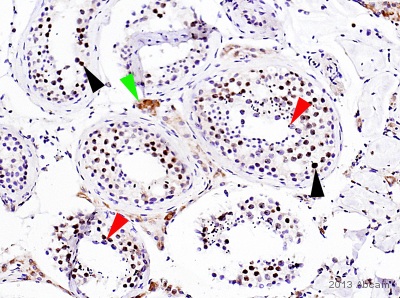 Immunohistochemistry (Formalin/PFA-fixed paraffin-embedded sections) - Anti-gamma H2A.X (phospho S139) antibody [EP854(2)Y] - BSA and Azide free (ab215967), expandable thumbnail