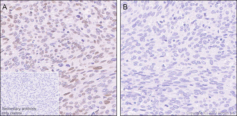 Immunohistochemistry (Formalin/PFA-fixed paraffin-embedded sections) - Anti-gamma H2A.X (phospho S139) antibody [EP854(2)Y] - BSA and Azide free (AB215967)
