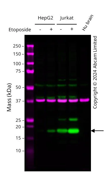 Anti-gamma H2A.X (phospho S139) antibody [EP854(2)Y