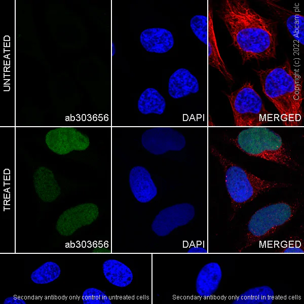 Immunocytochemistry/ Immunofluorescence - Anti-gamma H2A.X (phospho S139) antibody [N1-431] (AB303656)
