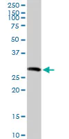 Western blot - Anti-gamma Sarcoglycan antibody (AB104478)