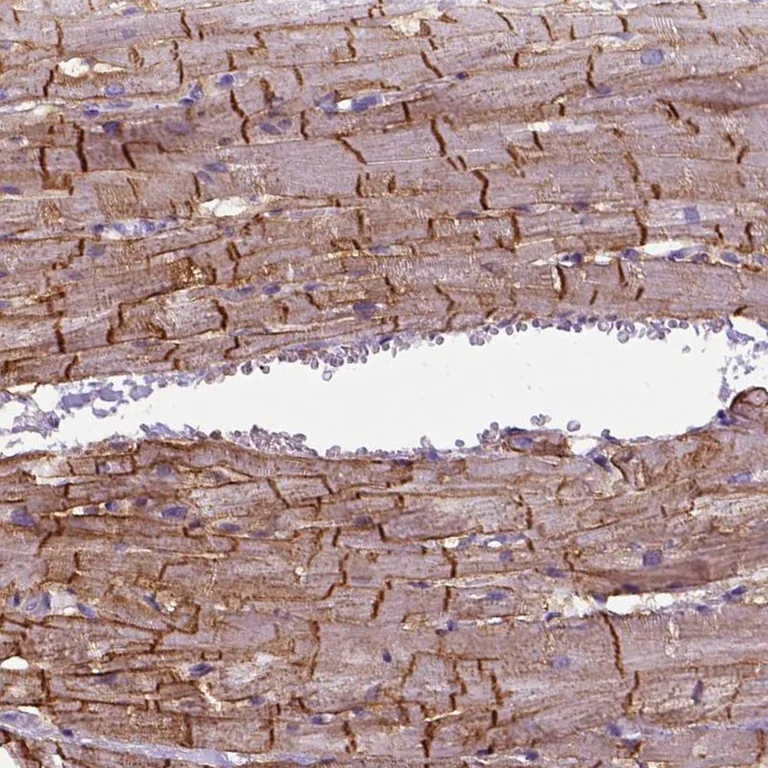 Immunohistochemistry (Formalin/PFA-fixed paraffin-embedded sections) - Anti-gamma Sarcoglycan antibody (AB251689)