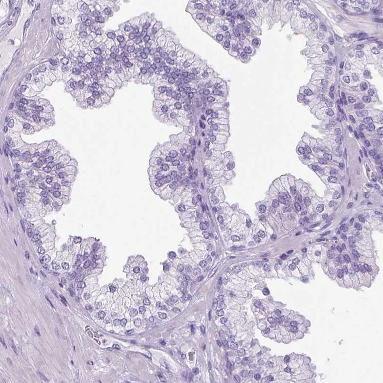 Immunohistochemistry (Formalin/PFA-fixed paraffin-embedded sections) - Anti-gamma Sarcoglycan antibody (AB251689)