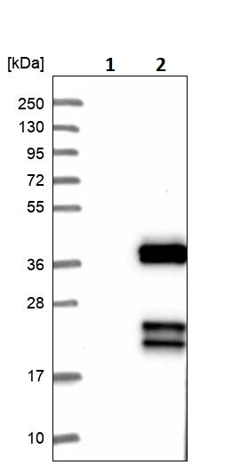 Western blot - Anti-gamma Sarcoglycan antibody (AB251689)