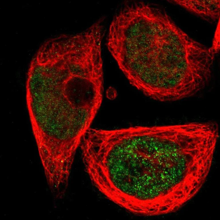 Immunocytochemistry/ Immunofluorescence - Anti-gamma Sarcoglycan antibody (AB251702)