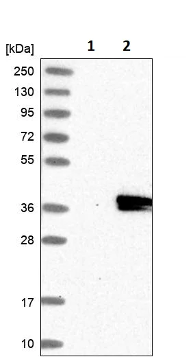 Western blot - Anti-gamma Sarcoglycan antibody (AB251702)