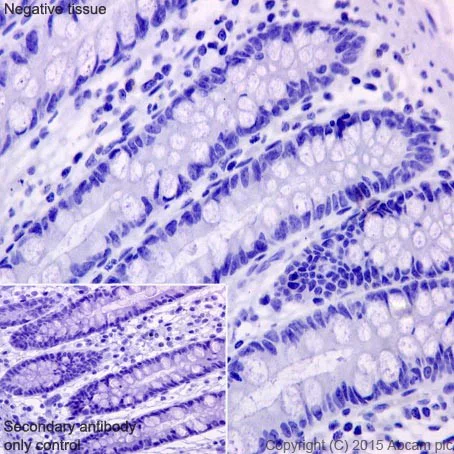 Immunohistochemistry (Formalin/PFA-fixed paraffin-embedded sections) - Anti-gamma Sarcoglycan antibody [EPR17862-40] (AB203112)