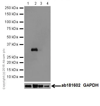 Western blot - Anti-gamma Sarcoglycan antibody [EPR17862-40] (AB203112)