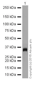 Western blot - Anti-gamma Sarcoglycan antibody [EPR17862-40] (AB203112)