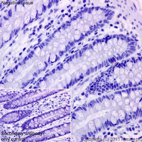 Immunohistochemistry (Formalin/PFA-fixed paraffin-embedded sections) - Anti-gamma Sarcoglycan antibody [EPR17862-40] - BSA and Azide free (AB240365)
