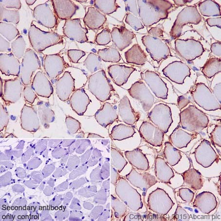 Immunohistochemistry (Formalin/PFA-fixed paraffin-embedded sections) - Anti-gamma Sarcoglycan antibody [EPR17862-40] - BSA and Azide free (AB240365)