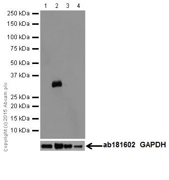 Western blot - Anti-gamma Sarcoglycan antibody [EPR17862-7] (AB203113)