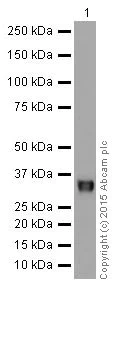 Western blot - Anti-gamma Sarcoglycan antibody [EPR17862-7] (AB203113)