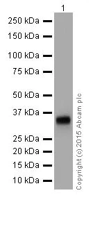 Western blot - Anti-gamma Sarcoglycan antibody [EPR17862-7] (AB203113)