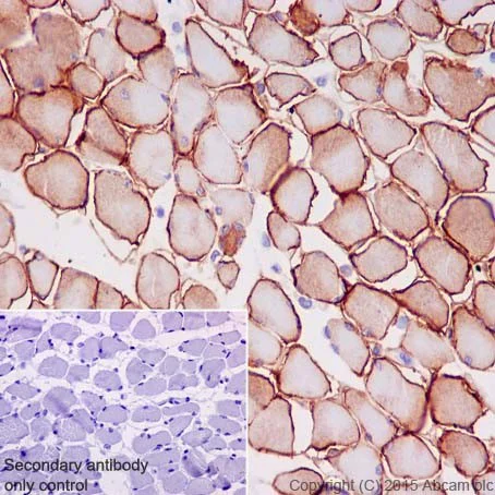 Immunohistochemistry (Formalin/PFA-fixed paraffin-embedded sections) - Anti-gamma Sarcoglycan antibody [EPR17862-7] - BSA and Azide free (AB251394)