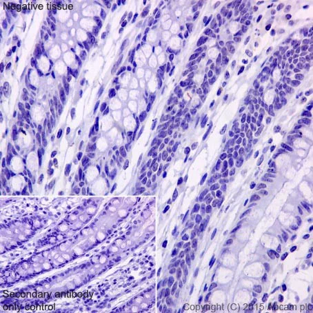 Immunohistochemistry (Formalin/PFA-fixed paraffin-embedded sections) - Anti-gamma Sarcoglycan antibody [EPR17862-7] - BSA and Azide free (AB251394)