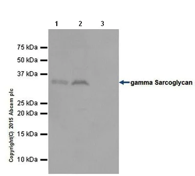 Immunoprecipitation - Anti-gamma Sarcoglycan antibody [EPR17862-7] - BSA and Azide free (AB251394)