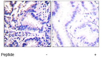 Immunohistochemistry (Formalin/PFA-fixed paraffin-embedded sections) - Anti-gamma Synuclein/SNCG antibody (AB55424)