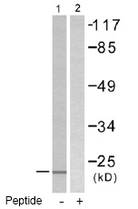 Anti-gamma Synuclein/SNCG antibody