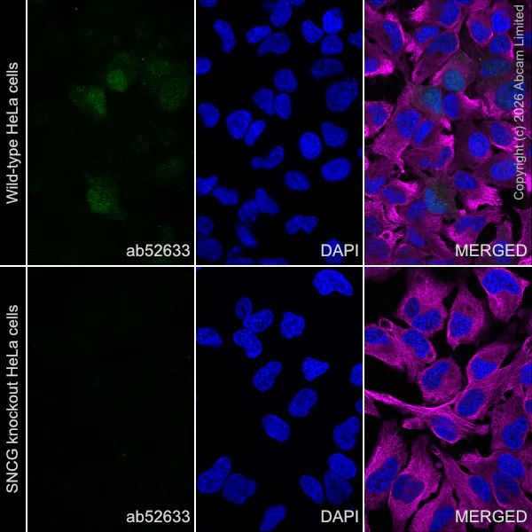 Immunocytochemistry/ Immunofluorescence - Anti-gamma Synuclein/SNCG antibody [EP1539Y] (AB52633)
