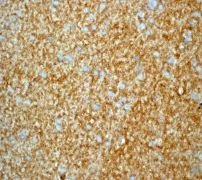 Immunohistochemistry (Formalin/PFA-fixed paraffin-embedded sections) - Anti-gamma Synuclein/SNCG antibody [EP1539Y] (AB52633)