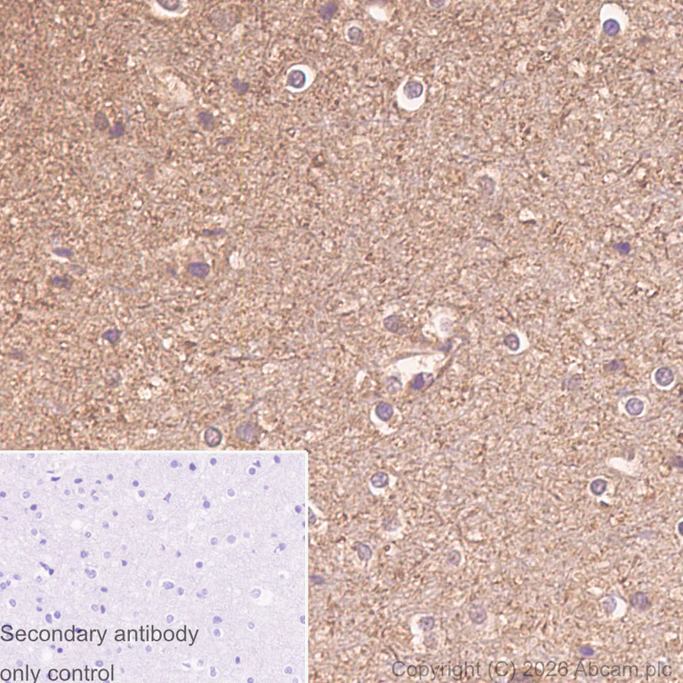 Immunohistochemistry (Formalin/PFA-fixed paraffin-embedded sections) - Anti-gamma Synuclein/SNCG antibody [EP1539Y] (AB52633)