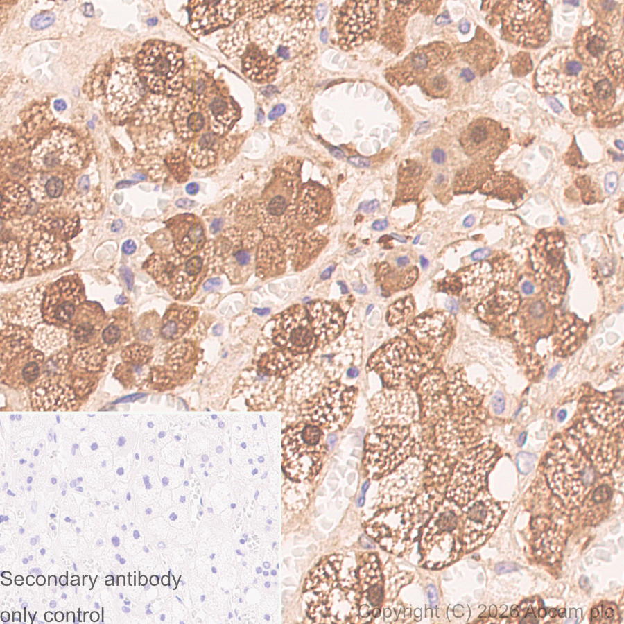 Immunohistochemistry (Formalin/PFA-fixed paraffin-embedded sections) - Anti-gamma Synuclein/SNCG antibody [EP1539Y] (AB52633)