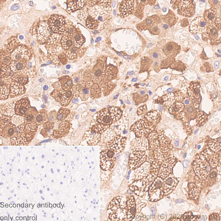 Immunohistochemistry (Formalin/PFA-fixed paraffin-embedded sections) - Anti-gamma Synuclein/SNCG antibody [EP1539Y] (AB52633)