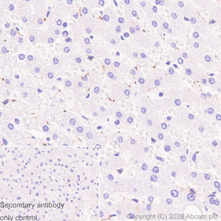 Immunohistochemistry (Formalin/PFA-fixed paraffin-embedded sections) - Anti-gamma Synuclein/SNCG antibody [EP1539Y] (AB52633)