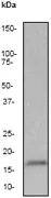Western blot - Anti-gamma Synuclein/SNCG antibody [EP1539Y] (AB52633)