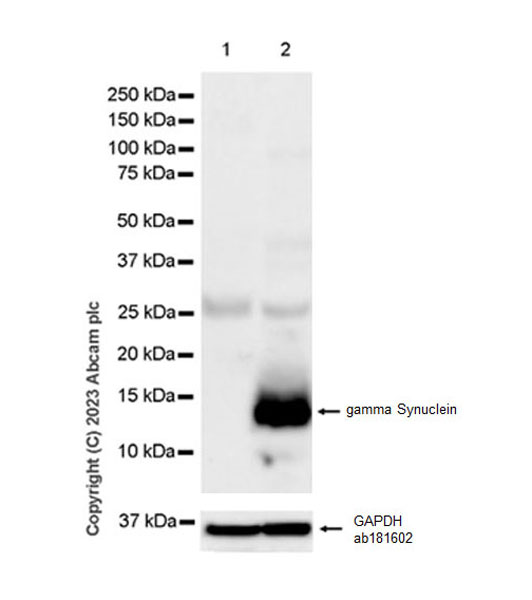 Western blot - Anti-gamma Synuclein/SNCG antibody [EPR26218-79] - BSA and Azide free (AB315443), expandable thumbnail