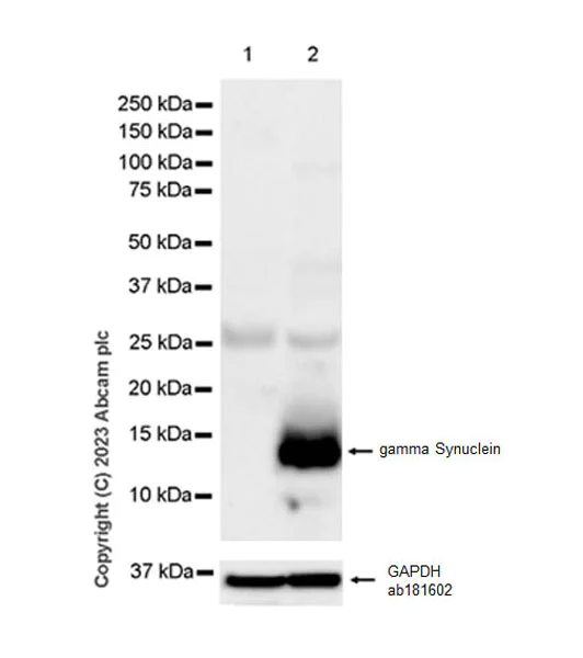 Western blot - Anti-gamma Synuclein/SNCG antibody [EPR26218-79] - BSA and Azide free (AB315443)