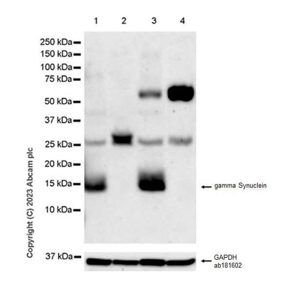 Western blot - Anti-gamma Synuclein/SNCG antibody [EPR26218-79] - BSA and Azide free (AB315443), expandable thumbnail
