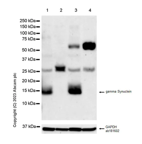 Western blot - Anti-gamma Synuclein/SNCG antibody [EPR26218-79] - BSA and Azide free (AB315443)