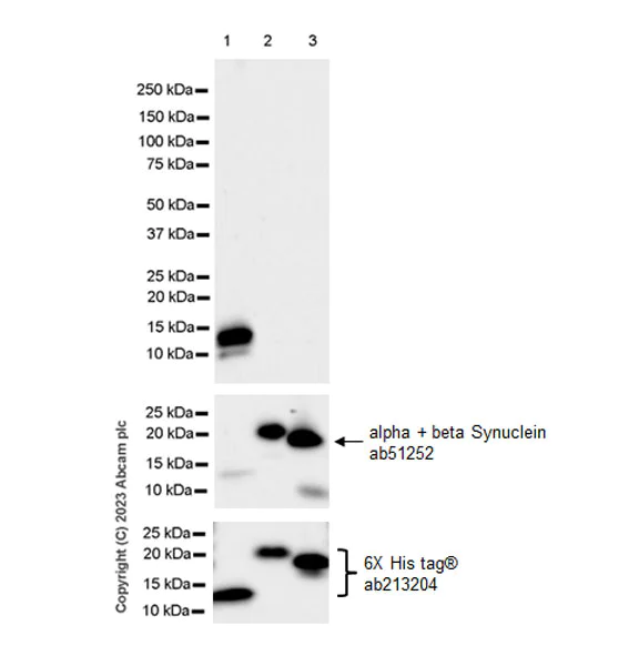 Western blot - Anti-gamma Synuclein/SNCG antibody [EPR26218-79] - BSA and Azide free (AB315443)