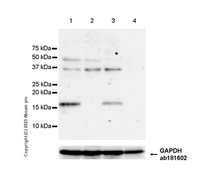 Western blot - Anti-gamma Synuclein/SNCG antibody [EPR26218-79] - BSA and Azide free (AB315443)