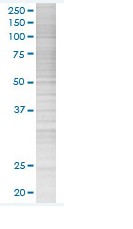 gamma Synuclein/SNCG overexpression 293T lysate (whole cell)