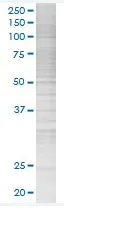 SDS-PAGE - gamma Synuclein/SNCG overexpression 293T lysate (whole cell) (AB94101)