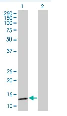 Western blot - gamma Synuclein/SNCG overexpression 293T lysate (whole cell) (AB94101)