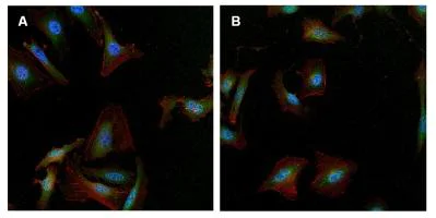 Immunocytochemistry/ Immunofluorescence - Anti-gamma Tubulin antibody [4D11] - C-terminal (AB173831)