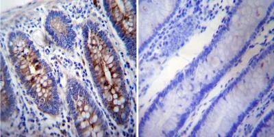 Immunohistochemistry (Formalin/PFA-fixed paraffin-embedded sections) - Anti-gamma Tubulin antibody [4D11] - C-terminal (AB173831)