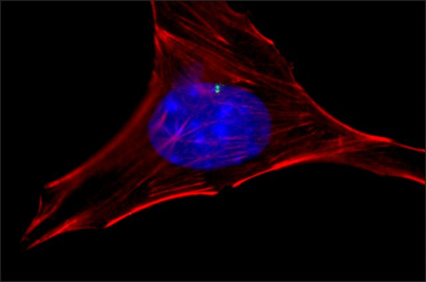 Immunocytochemistry/ Immunofluorescence - Anti-gamma Tubulin antibody - Centrosome Marker (AB11317), expandable thumbnail