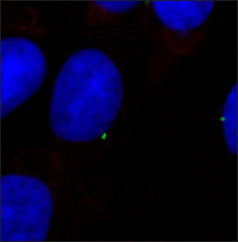 Immunocytochemistry/ Immunofluorescence - Anti-gamma Tubulin antibody - Centrosome Marker (AB11317), expandable thumbnail