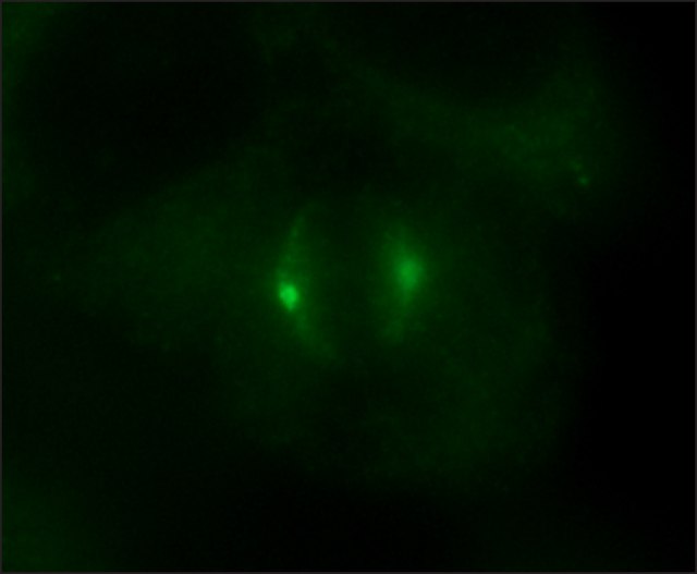 Immunocytochemistry - Anti-gamma Tubulin antibody - Centrosome Marker (AB11321), expandable thumbnail