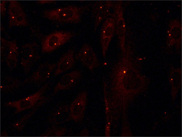 Immunocytochemistry - Anti-gamma Tubulin antibody - Centrosome Marker (AB11321), expandable thumbnail