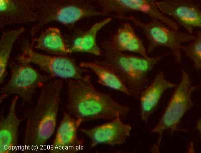 Immunocytochemistry - Anti-gamma Tubulin antibody - Centrosome Marker (AB11321), expandable thumbnail
