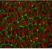 Immunocytochemistry/ Immunofluorescence - Anti-gamma Tubulin antibody - Centrosome Marker (AB137822), expandable thumbnail