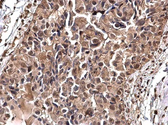 Immunohistochemistry (Formalin/PFA-fixed paraffin-embedded sections) - Anti-gamma Tubulin antibody - Centrosome Marker (AB137822)