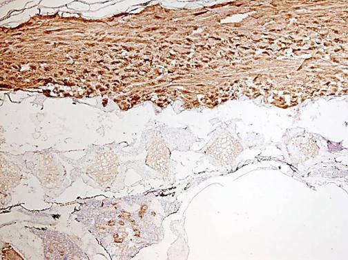 Immunohistochemistry (Formalin/PFA-fixed paraffin-embedded sections) - Anti-gamma Tubulin antibody (AB209831), expandable thumbnail